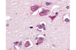 Immunohistochemistry of TRAIL in human brain tissue with this product at 20 μg/ml.