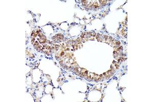 Immunohistochemistry of paraffin-embedded mouse lung using BNIP3L Rabbit pAb (ABIN6129989, ABIN6137622, ABIN6137623 and ABIN6221881) at dilution of 1:100 (40x lens). (BNIP3L/NIX Antikörper  (AA 1-187))