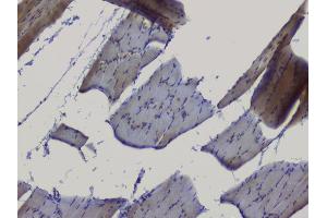 IHC analysis of NRF1 using anti-NRF1 antibody (ABIN6719347). (NRF1 Antikörper  (AA 246-503))