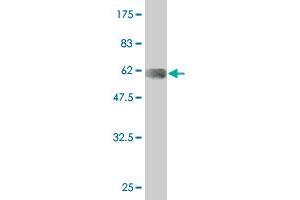 Western Blot detection against Immunogen (56. (LIM Domain Binding 3 Protein Antikörper  (AA 1-283))