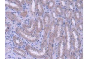 Immunohistochemistry (IHC) image for anti-ATP-Binding Cassette, Sub-Family G (WHITE), Member 8 (ABCG8) (AA 1-271) antibody (ABIN5013204)