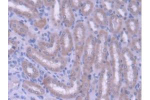 DAB staining on IHC-P; Samples: Rat Kidney Tissue (ABCG8 Antikörper  (AA 1-271))