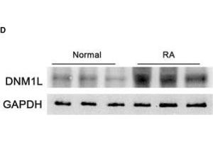 Enhanced mitochondrial fission in STs of RA patients correlates with disease severity. (GAPDH Antikörper)