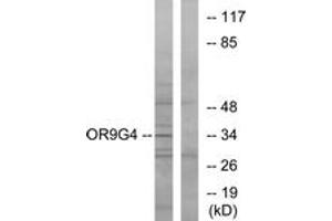 Western blot analysis of extracts from HeLa cells, using OR9G4 Antibody.
