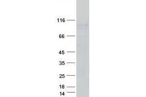 Validation with Western Blot (ATP1A1 Protein (Transcript Variant 1) (Myc-DYKDDDDK Tag))