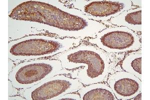 IHC analysis of HOOK3 using anti-HOOK3 antibody (ABIN6719547). (HOOK3 Antikörper  (AA 14-198))