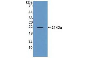 Detection of Recombinant PTPN13, Human using Polyclonal Antibody to Protein Tyrosine Phosphatase, Non Receptor Type 13 (PTPN13) (PTPN13 Antikörper  (AA 1-161))