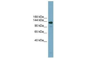 ASXL2 antibody used at 1 ug/ml to detect target protein. (ASXL2 Antikörper)
