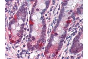 Image no. 1 for anti-Nucleotide-Binding Oligomerization Domain Containing 2 (NOD2) (C-Term) antibody (ABIN372922) (NOD2 Antikörper  (C-Term))