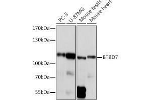 Western blot analysis of extracts of various cell lines, using BTBD7 Rabbit pAb (ABIN7265954) at 1:1000 dilution. (BTBD7 Antikörper)
