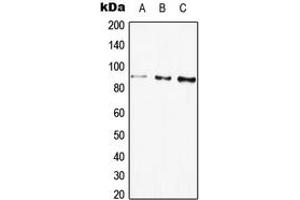 Western blot analysis of Beta-galactosidase expression in HEK293T (A), HepG2 (B), PC12 (C) whole cell lysates. (GLB1 Antikörper  (Center))