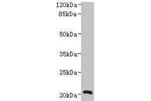 Western blot All lanes: NICN1 antibody at 4 μg/mL + U937 whole cell lysate Secondary Goat polyclonal to rabbit IgG at 1/10000 dilution Predicted band size: 25, 20 kDa Observed band size: 20 kDa (NICN1 Antikörper  (AA 1-213))