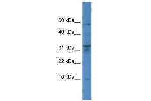 WB Suggested Anti-CTSC Antibody Titration: 0. (CTSC Antikörper  (Middle Region))