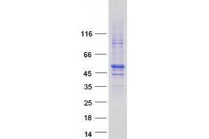 Validation with Western Blot (ZNHIT2 Protein (Myc-DYKDDDDK Tag))