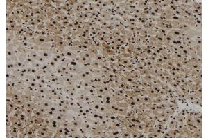 ABIN6267179 at 1/100 staining Mouse liver tissue by IHC-P. (SHP1 Antikörper  (pTyr564))