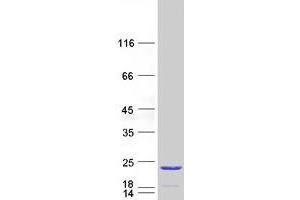 TPPP2 Protein (Myc-DYKDDDDK Tag)