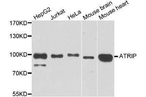 Western blot analysis of extracts of various cell lines, using ATRIP antibody. (ATRIP Antikörper  (AA 1-260))