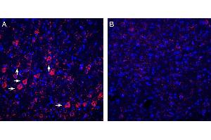 Expression of P2Y6 in rat cortex. (P2RY6 Antikörper  (C-Term, Intracellular))