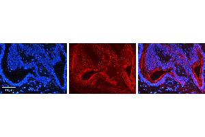 Rabbit Anti-AKT1 Antibody  AV Formalin Fixed Paraffin Embedded Tissue: Human Lung Tissue Observed Staining: Cytoplasm, Plasma membrane Primary Antibody Concentration: 1:600 Other Working Concentrations: N/A Secondary Antibody: Donkey anti-Rabbit-Cy3 Secondary Antibody Concentration: 1:200 Magnification: 20X Exposure Time: 0.