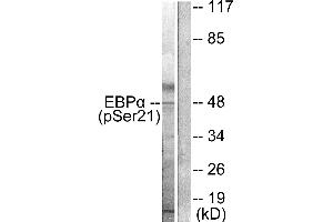 Western blot analysis of extracts from HepG2 cells treated with EGF (200ng/ml, 5mins), using C/EBP-α (phospho-Ser21) antibody. (CEBPA Antikörper  (pSer21))