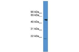 WB Suggested Anti-ALS2CR12 Antibody Titration: 0. (ALS2CR12 Antikörper  (N-Term))