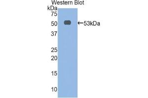 Detection of Recombinant aFP, Rat using Polyclonal Antibody to Alpha-Fetoprotein (AFP) (alpha Fetoprotein Antikörper  (AA 409-611))