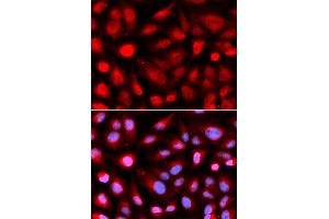 Immunofluorescence analysis of U2OS cell using RPL5 antibody. (RPL5 Antikörper  (AA 1-95))