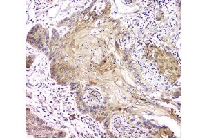 IHC analysis of RAB11B using anti-RAB11B antibody (ABIN6719364). (RAB11B Antikörper)