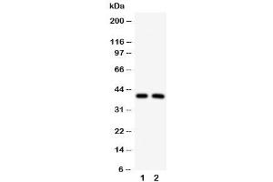 Western blot testing of IRF2 antibody and Lane 1:  HeLa (IRF2 Antikörper  (C-Term))