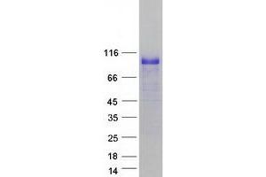 Western Blotting (WB) image for Hypermethylated in Cancer 1 (HIC1) (Transcript Variant 1) protein (Myc-DYKDDDDK Tag) (ABIN2722722)