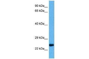 Host:  Mouse  Target Name:  PLP1  Sample Tissue:  Mouse Heart  Antibody Dilution:  1ug/ml (PLP1 Antikörper  (Middle Region))