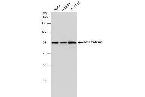 WB Image beta Catenin antibody [N1N2-2], N-term detects beta Catenin protein by western blot analysis. (CTNNB1 Antikörper  (N-Term))