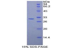 SDS-PAGE (SDS) image for Transaldolase 1 (TALDO1) (AA 35-285) protein (His tag) (ABIN2127042) (TALDO1 Protein (AA 35-285) (His tag))