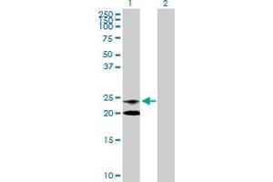 Western Blot analysis of NAAA expression in transfected 293T cell line by NAAA MaxPab polyclonal antibody. (NAAA Antikörper  (AA 1-199))