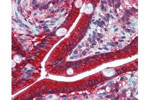 Anti-CES2 / Esterase antibody IHC of human small intestine.