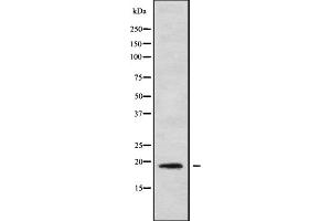Western blot analysis IL1F9 using COLO205 whole cell lysates (IL1F9 Antikörper  (N-Term))