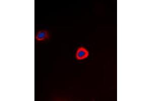 Immunofluorescent analysis of PAK1 (pT212) staining in Hela cells. (PAK1 Antikörper  (pSer212))