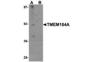 Western blot analysis in rat brain tissue lysate with TMEM184A Antibody  at 1 μg/ml in the absence (A) and the presence (B) of blocking peptide. (TMEM184A Antikörper  (C-Term))