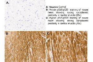 Immunohistochemistry with anti-myosin pS19/pS20 antibody showing strong cytoplasmic staining of myocytes in mouse heart muscle 20x and 40x (B & C). (Myosin Antikörper  (pSer19, pSer20))