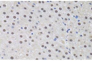 Immunohistochemistry of paraffin-embedded Rat liver using HUS1 Polyclonal Antibody at dilution of 1:100 (40x lens). (HUS1 Antikörper)