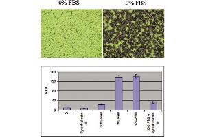 Migration of Human Fibrosarcoma HT-1080 Cells.