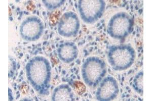 Immunohistochemistry (IHC) image for anti-C-Type Lectin Domain Family 4, Member M (CLEC4M) (AA 242-399) antibody (ABIN7441907)