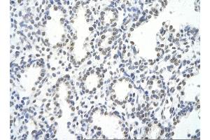 Rabbit Anti-HNRPA1 antibody   Paraffin Embedded Tissue: Human Lung cell Cellular Data: alveolar cell of renal tubule Antibody Concentration: 4. (HNRNPA1 Antikörper  (C-Term))