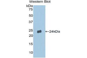 Western Blotting (WB) image for anti-Matrix Metallopeptidase 13 (Collagenase 3) (MMP13) (AA 290-468) antibody (ABIN1859847) (MMP13 Antikörper  (AA 290-468))