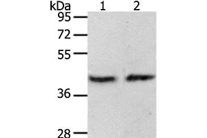 Western Blot analysis of MCF7 cell and Mouse brain tissue using PAX8 Polyclonal Antibody at dilution of 1:250 (PAX8 Antikörper)