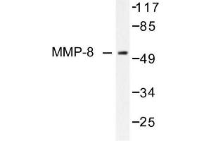 Image no. 1 for anti-Matrix Metallopeptidase 8 (Neutrophil Collagenase) (MMP8) antibody (ABIN265533)
