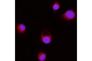 IF analysis of ERLIN2 using anti-ERLIN2 antibody (ABIN7602582).