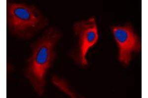 Immunofluorescent analysis of 14-3-3 zeta staining in MCF7 cells. (14-3-3 zeta Antikörper  (C-Term))