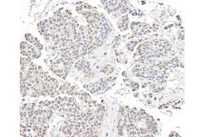Immunohistochemistry (IHC) image for anti-Chromodomain Helicase DNA Binding Protein 8 (CHD8) (AA 325-350) antibody (ABIN7453579)