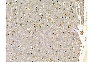 anti-Angel Homolog 2 (ANGEL2) antibody